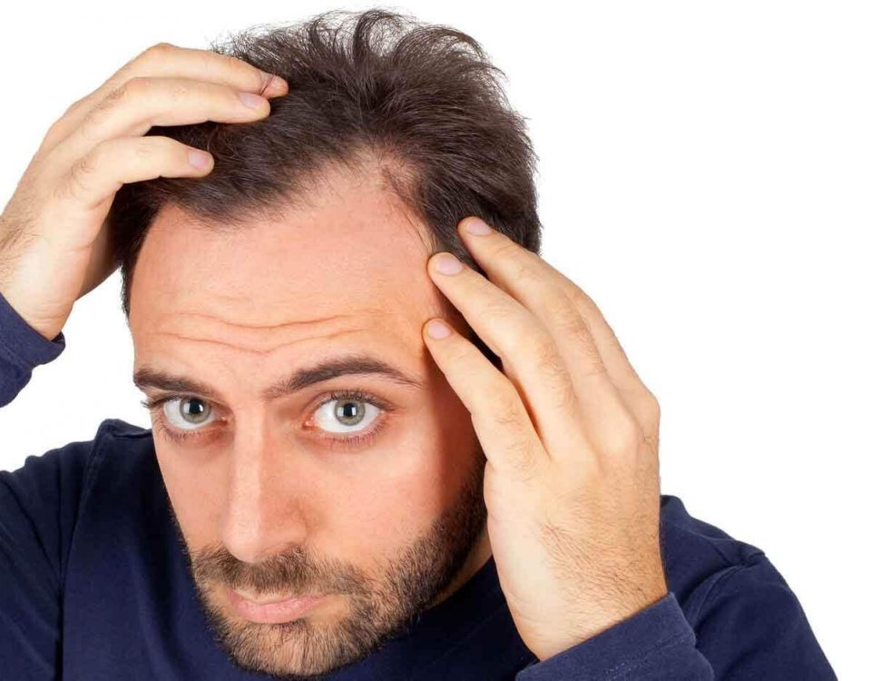 پیوند مو چیست؟