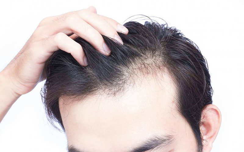 گرافت مو چیست و چه مفهومی دارد؟ - مووان