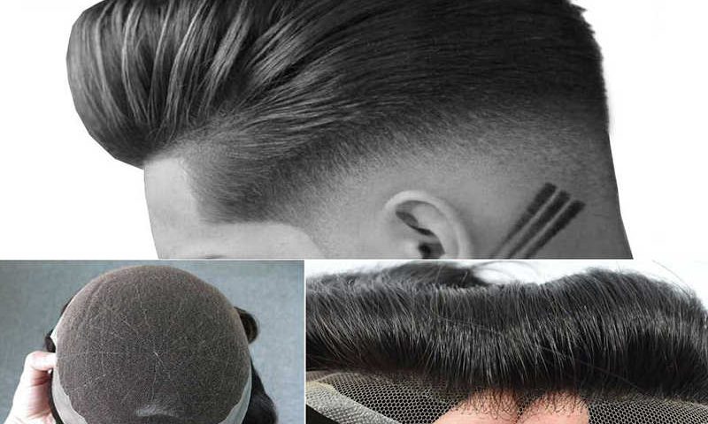 معایب ترمیم مو در مقایسه با انواع روش های کاشت مو - موی وان