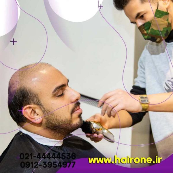 نمونه کار نصب پروتز مو به روش بافت-ترمیم مو-کاشتمو-نمونه کار ترمیم مو-مو وان-نصب پروتز مو-ترمیم مو در تهران